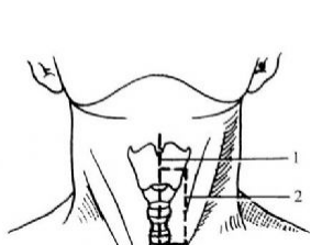 咽喉-头颈亚专业
