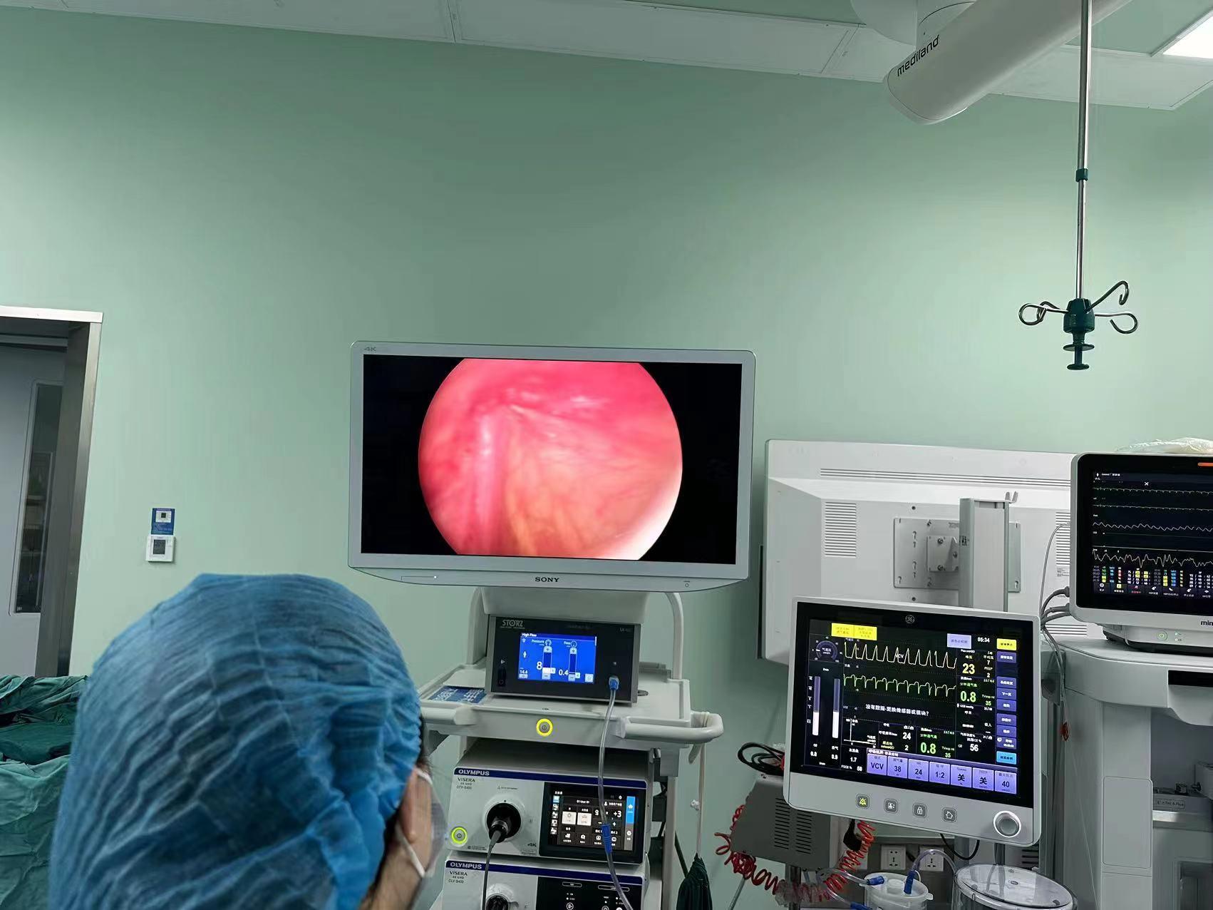 小创口解决大问题我院小儿外科成功为出生27天新生儿嵌顿疝行腹腔镜